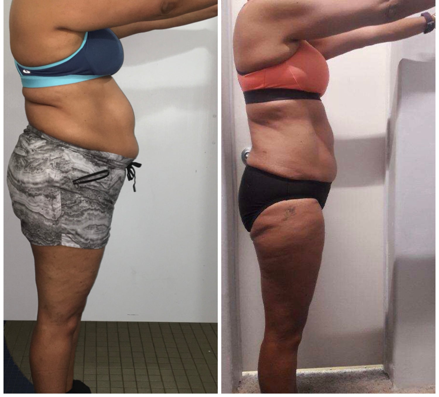 image comparison after