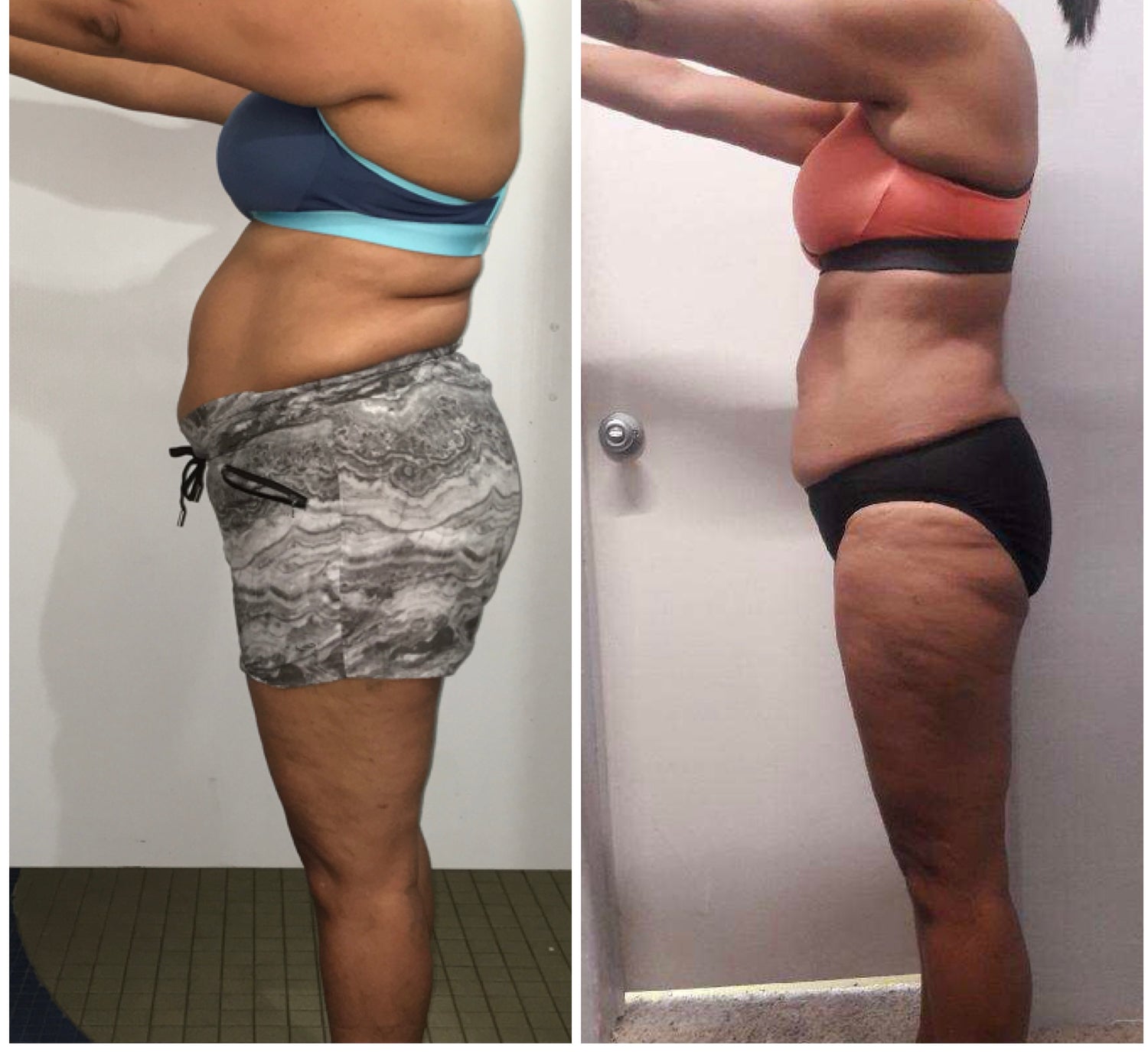 image comparison before